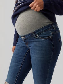 MAMA.LICIOUS Krój skinny Jeans -Medium Blue Denim - 20017992